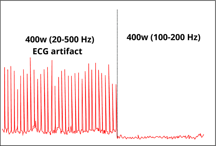 Bandwidth effect on ECG artifact