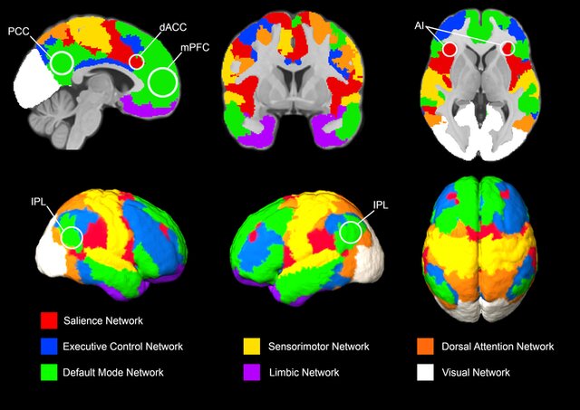 Brain networks