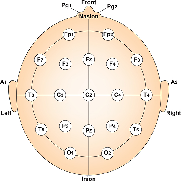 Vertex location