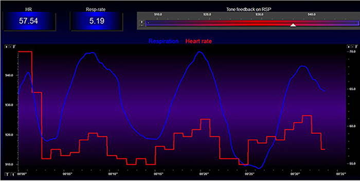 Perfect phase relationship