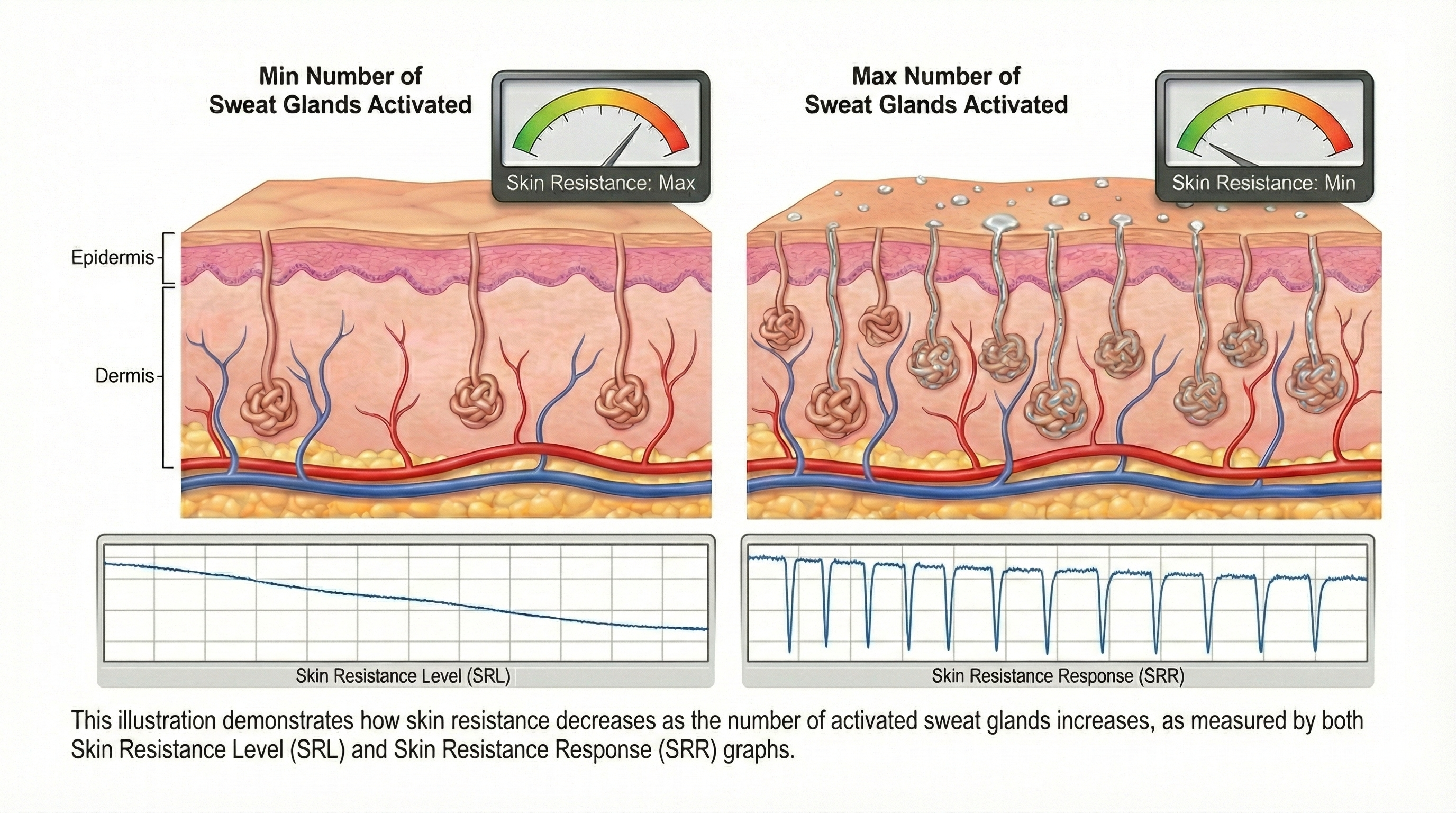 Graph showing inverse relationship between skin resistance and number of active sweat glands