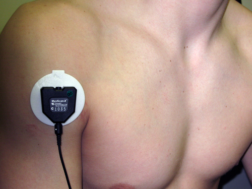 anterior deltoid