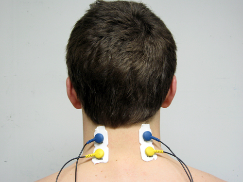 cervical