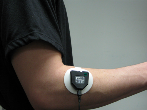 forearm extensor