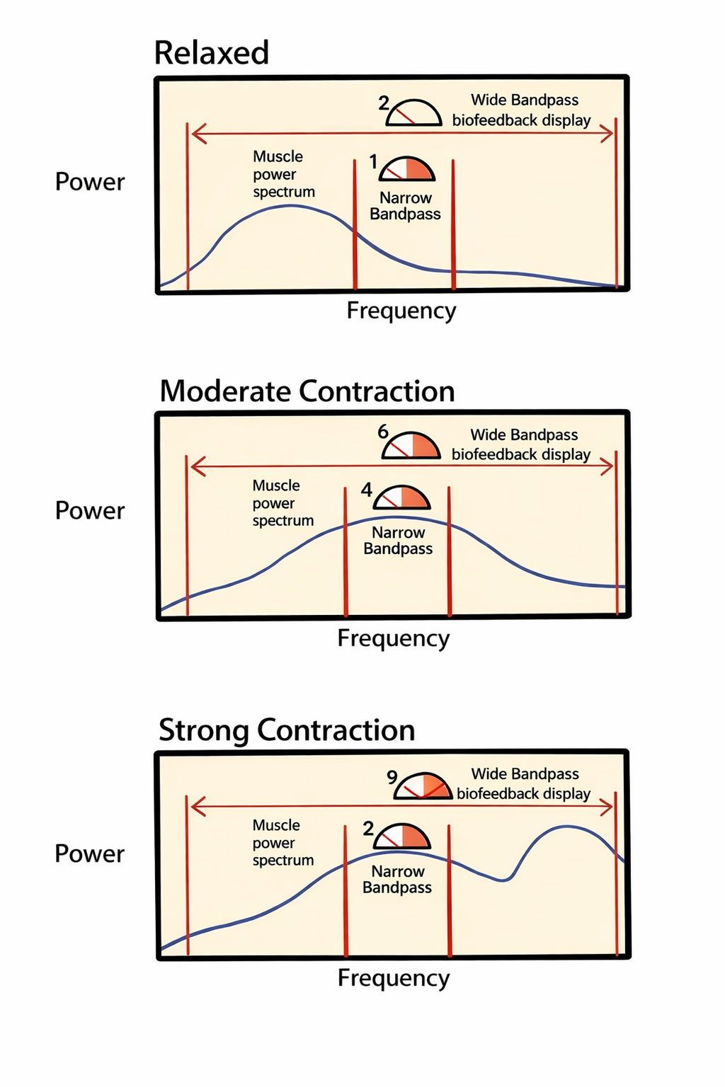 Effect of bandpass on SEMG readings