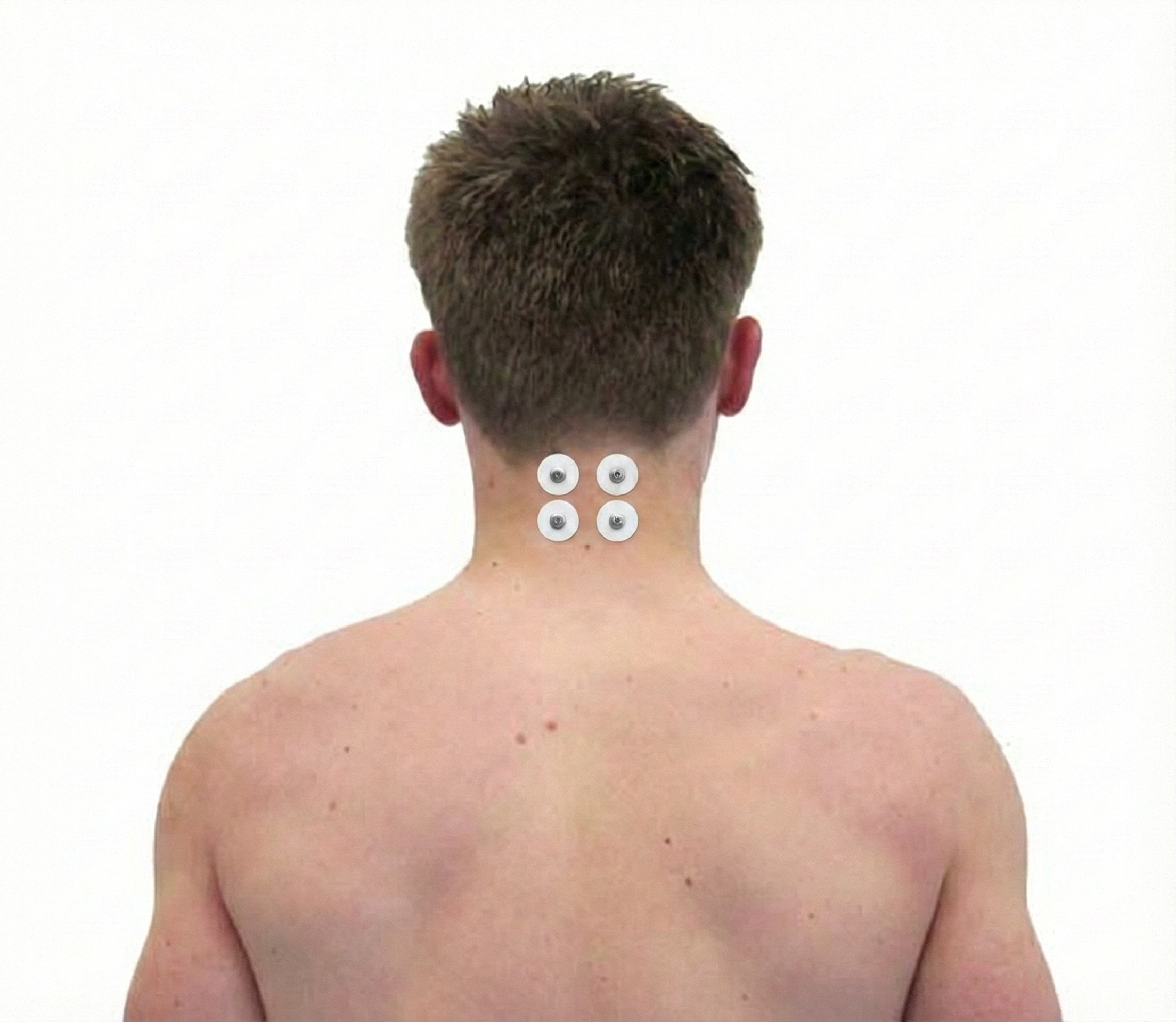 Cervical paraspinal electrode placement