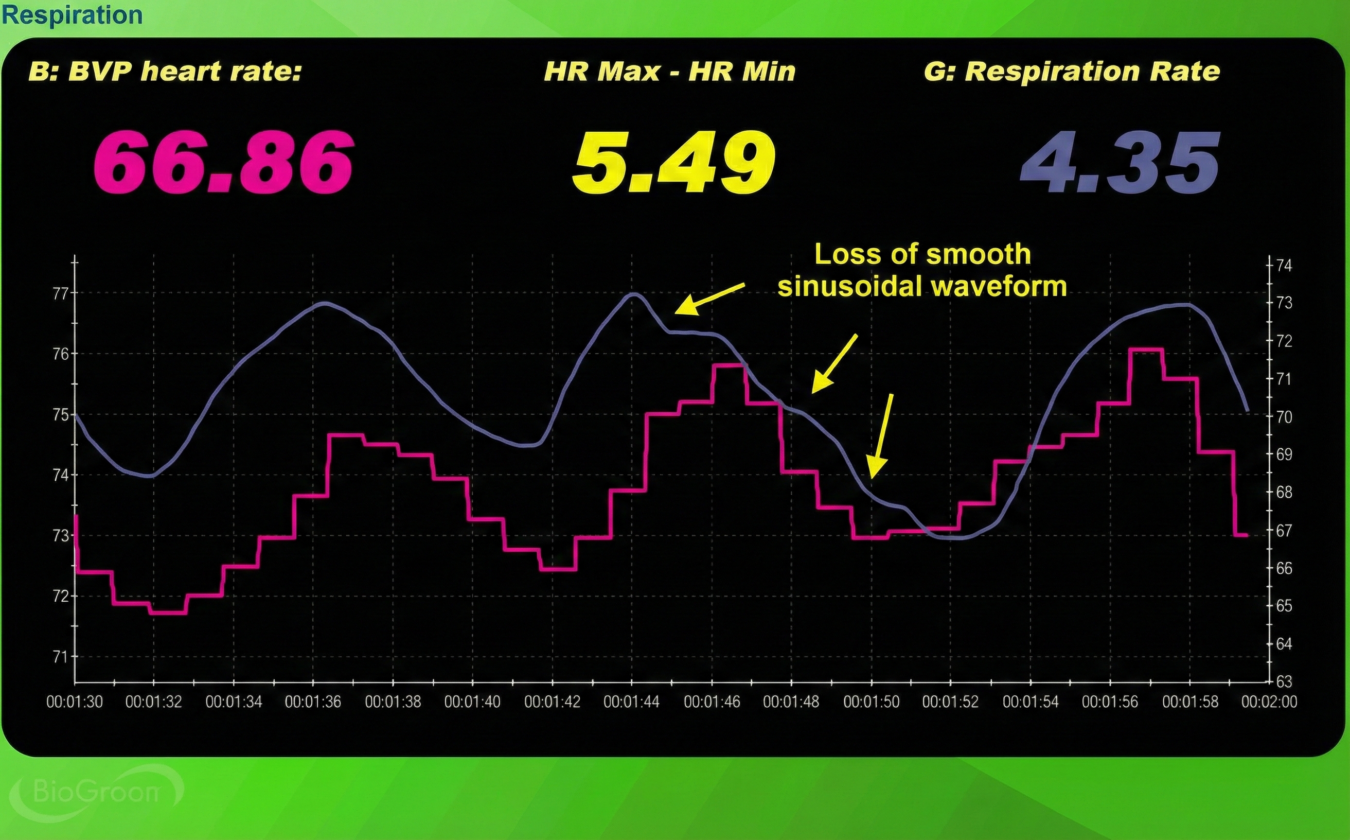 Respirometer waveform showing effort