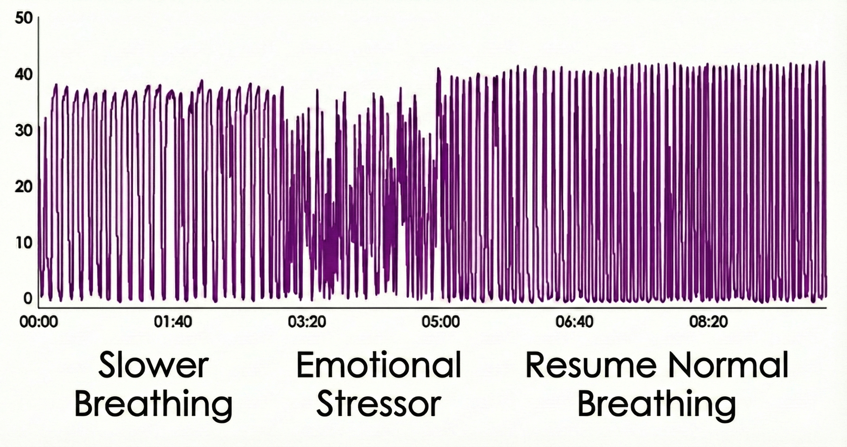 Capnometer response to emotional stressor