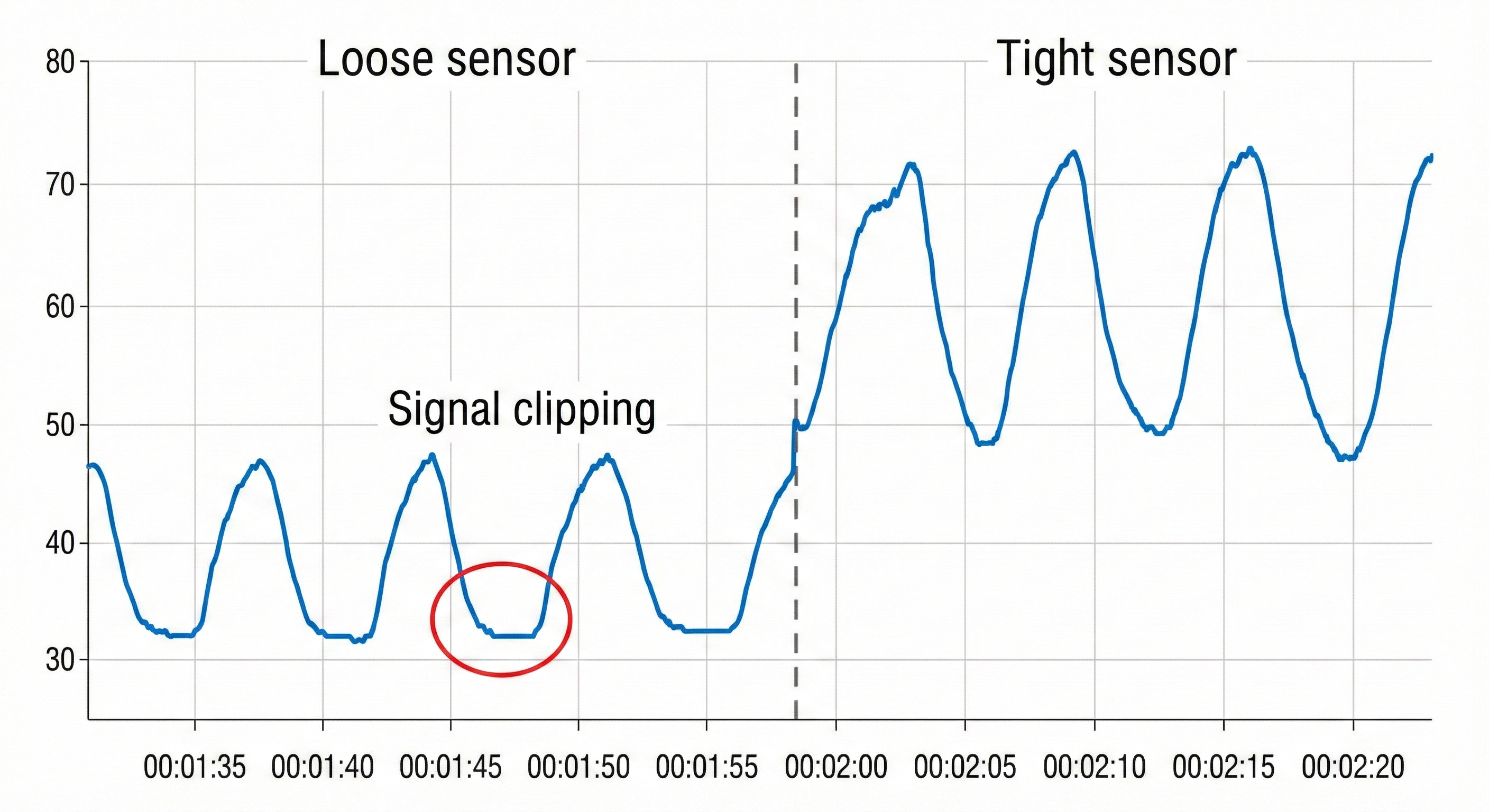 Signal clipping artifact