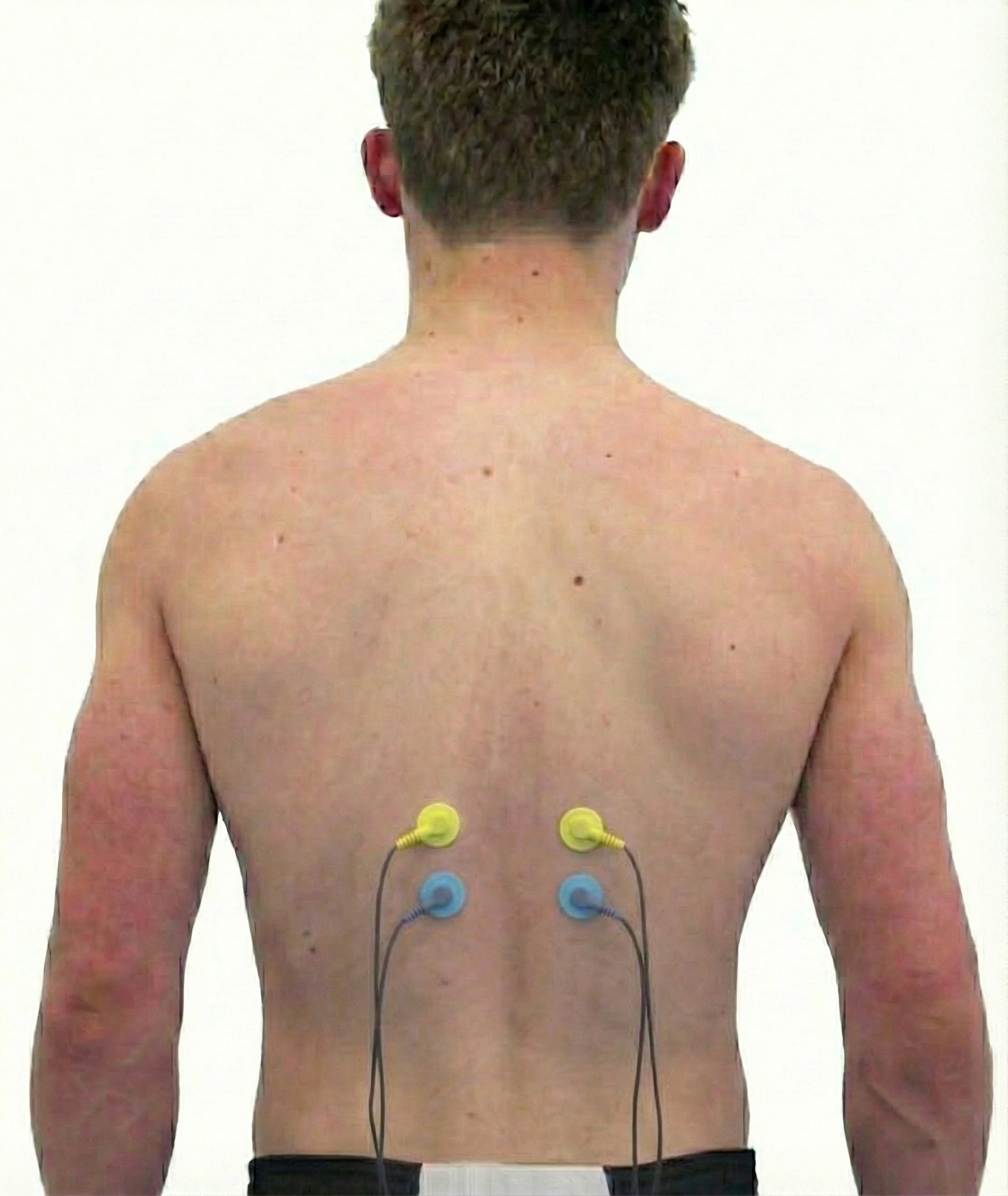 Bilateral lumbar monitoring