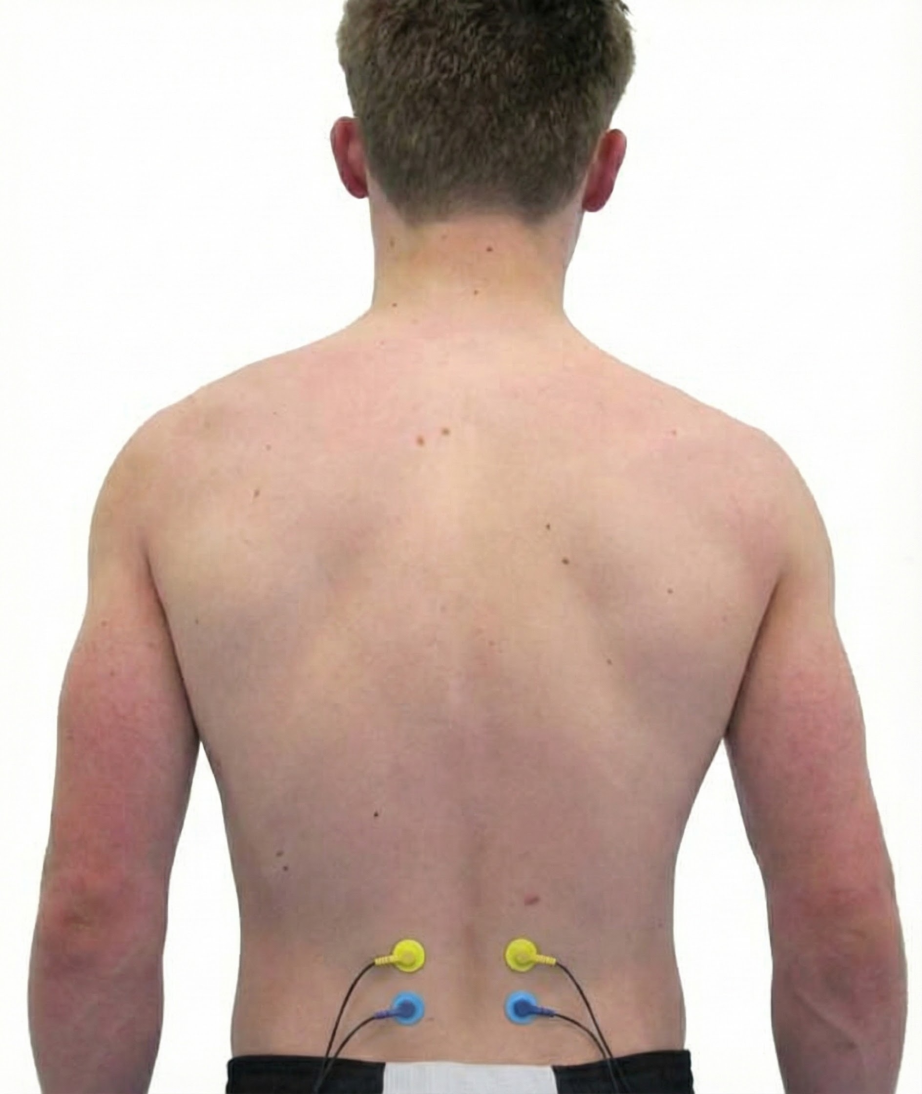 Erector spinae sensor placement
