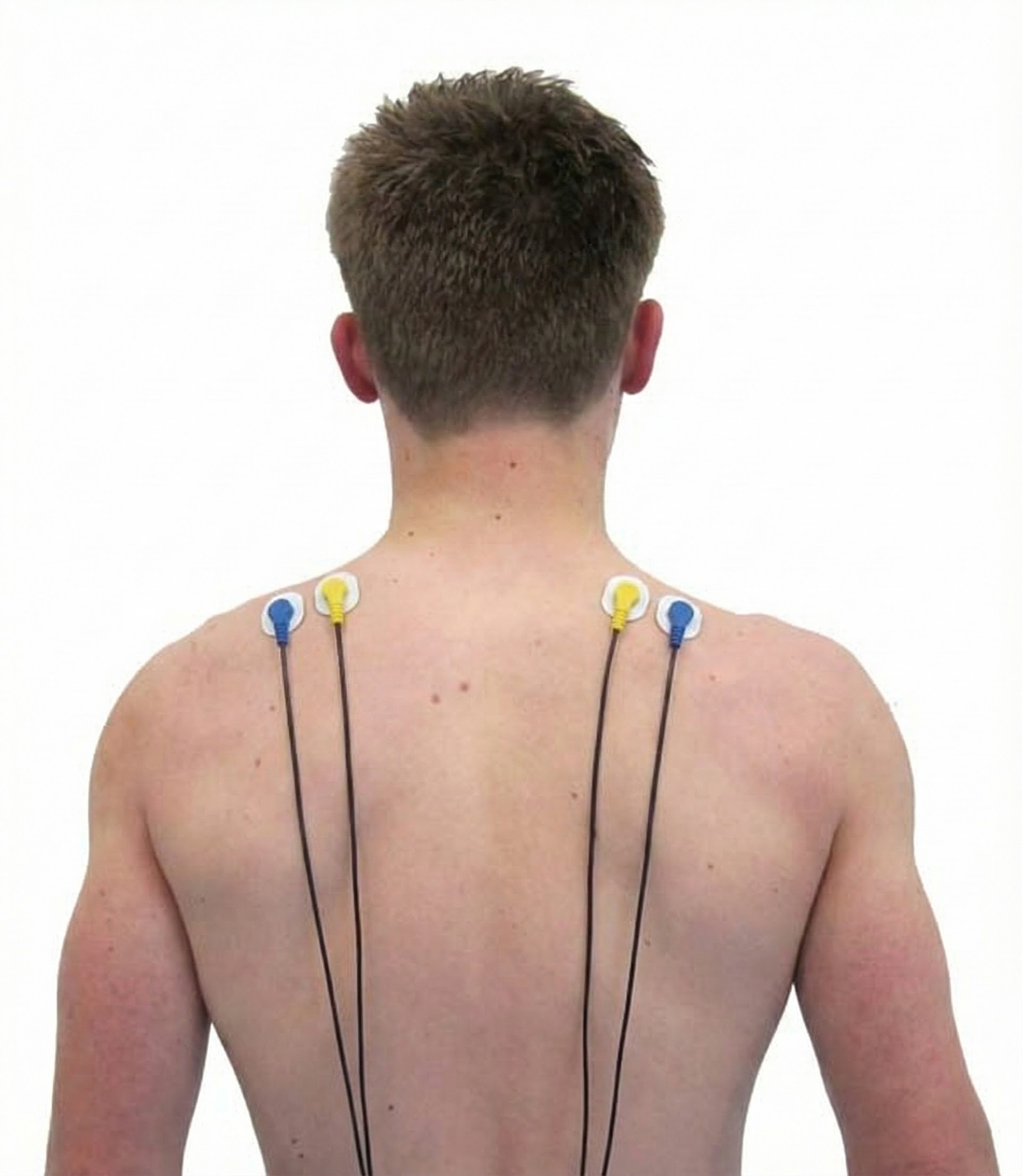 Bilateral upper trapezius wide bandpass