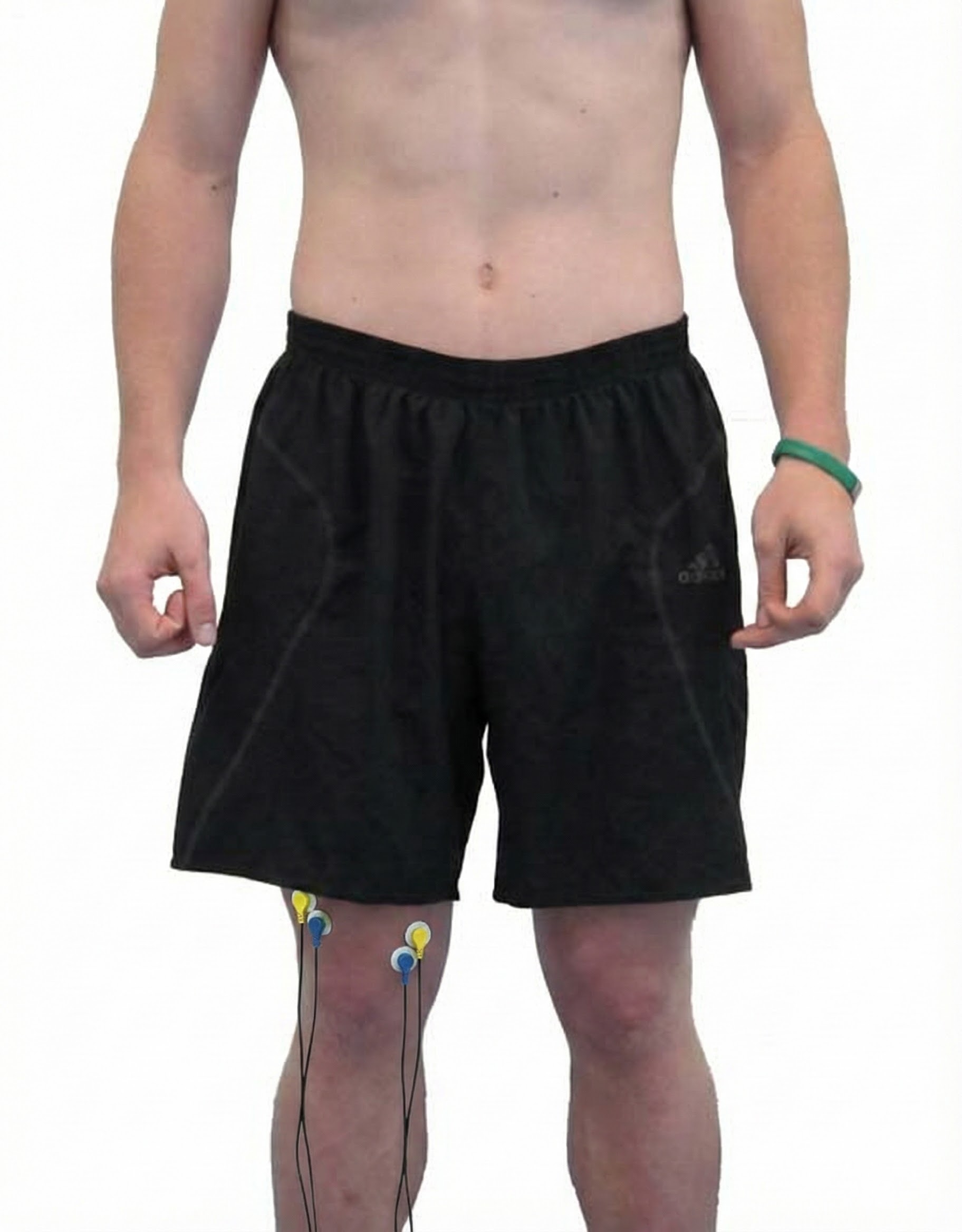 Vastus lateralis and medialis sensor placement