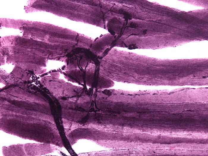 Neuromuscular junction photomicrograph