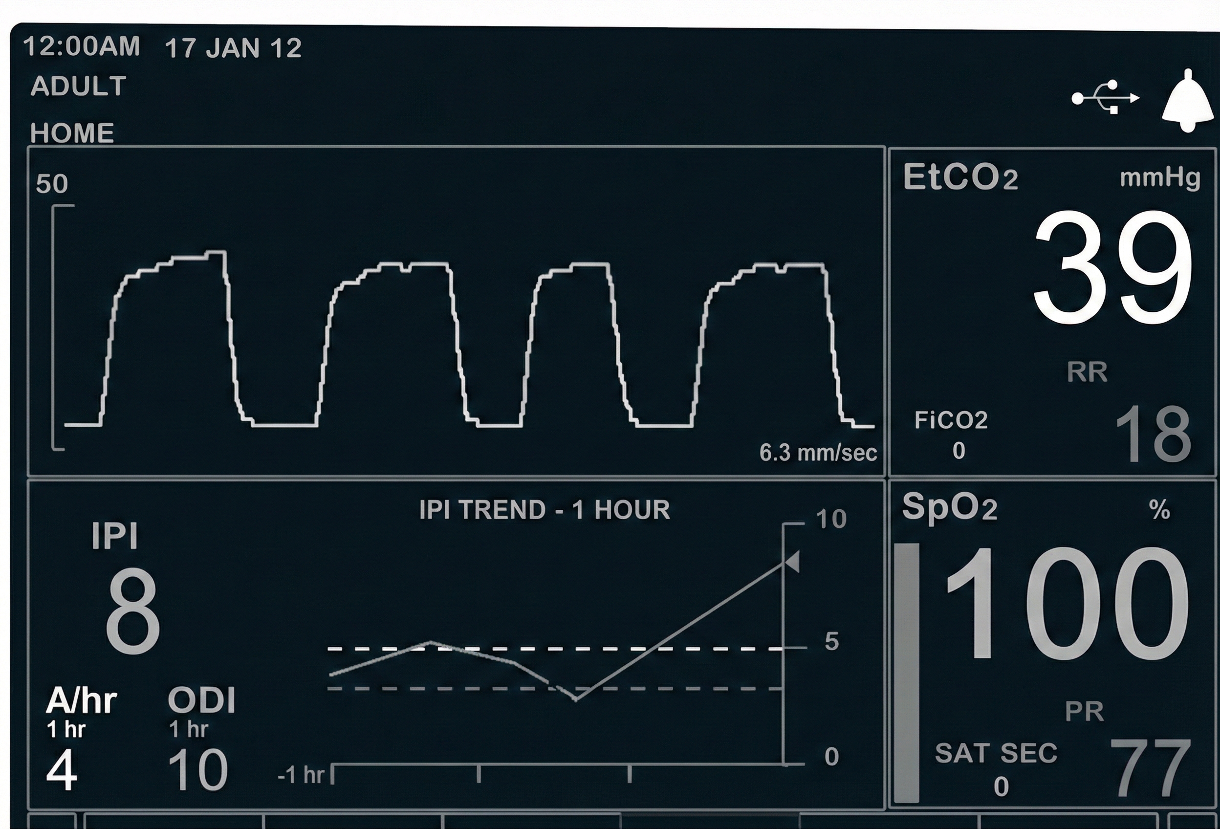 Normal capnometer waveform
