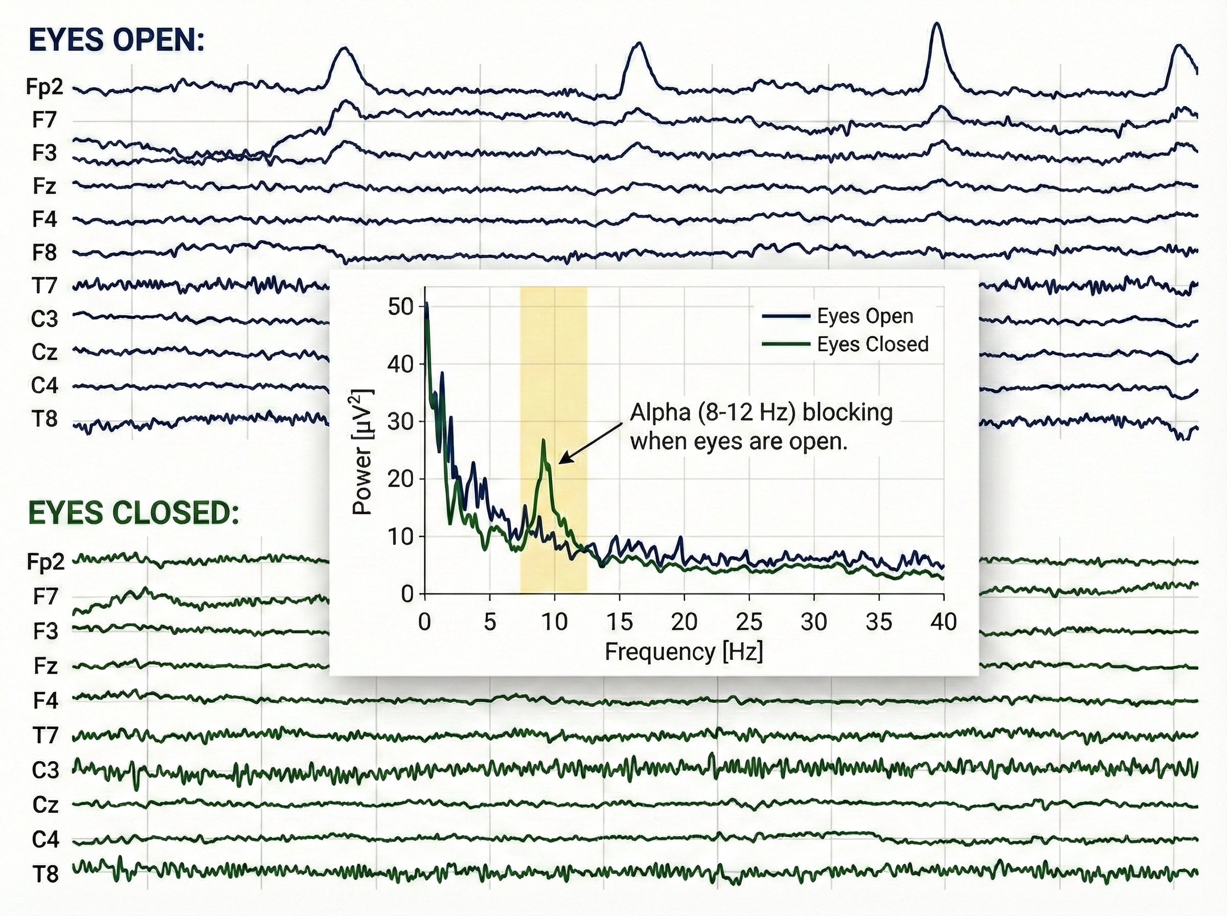 Alpha blocking demonstration