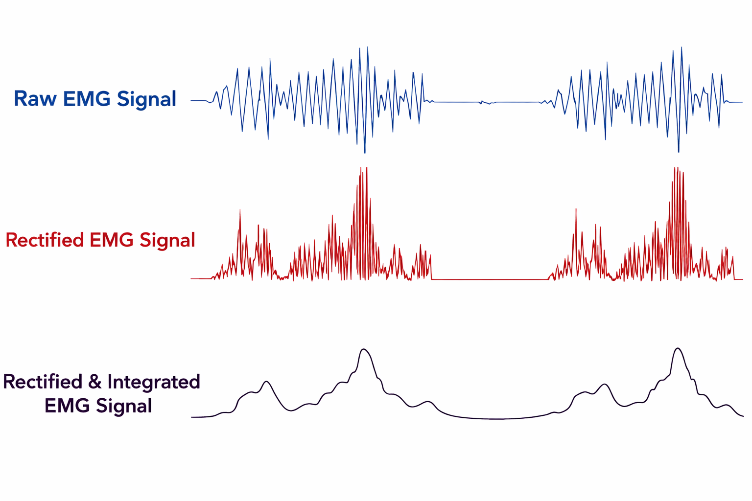 Raw, rectified, and integrated SEMG