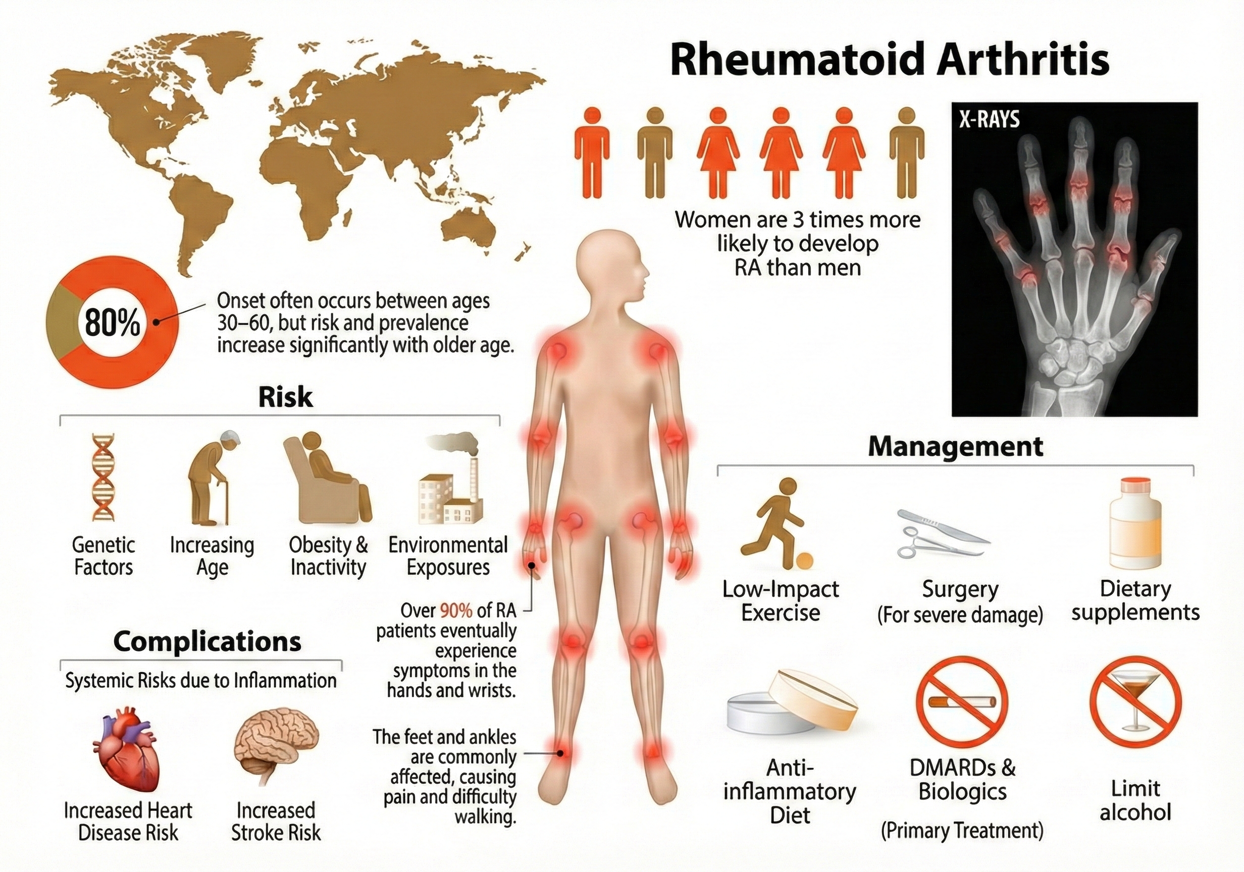 Rheumatoid arthritis illustration