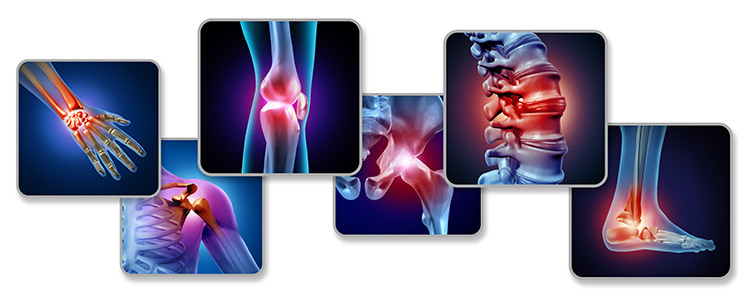 Types of joint disorders