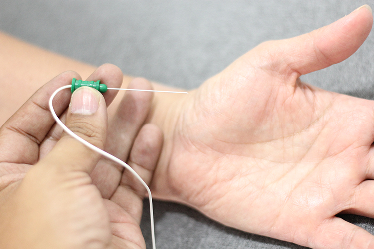 Needle electrode