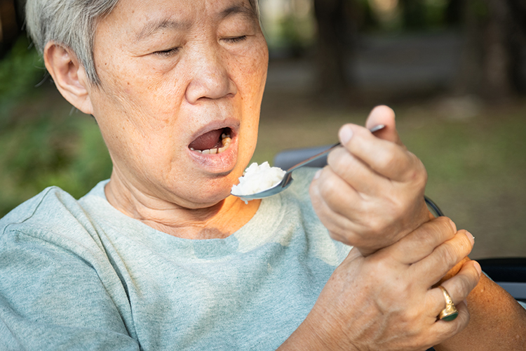 Stroke patient in rehabilitation