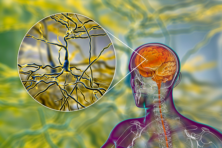 Pyramidal neurons