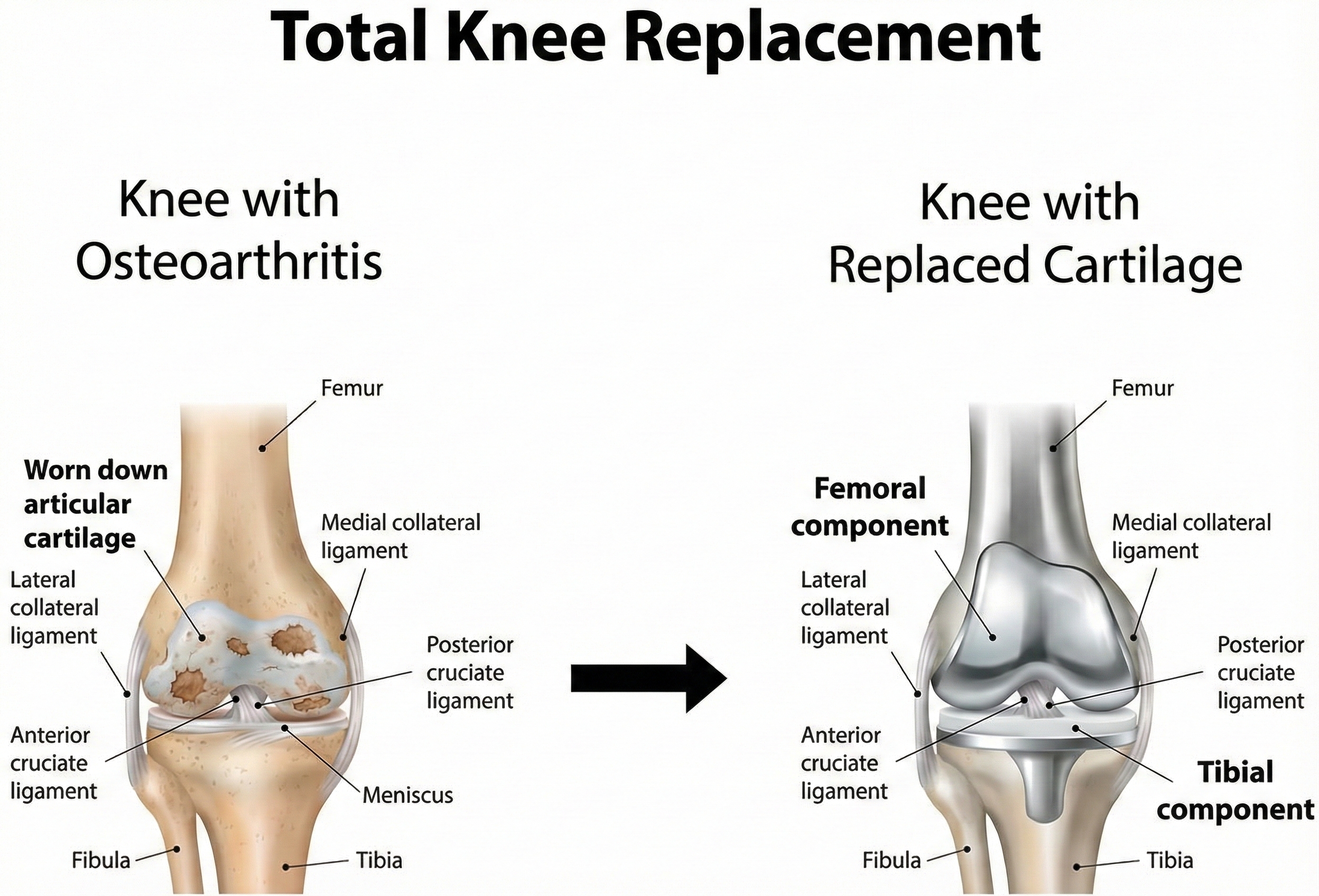 Knee joint anatomy