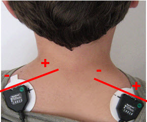 Upper trapezius placement