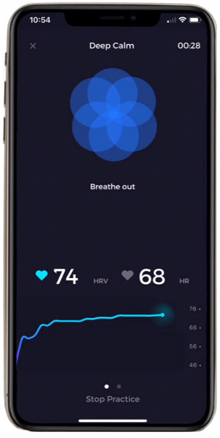 Elite HRV feedback screen