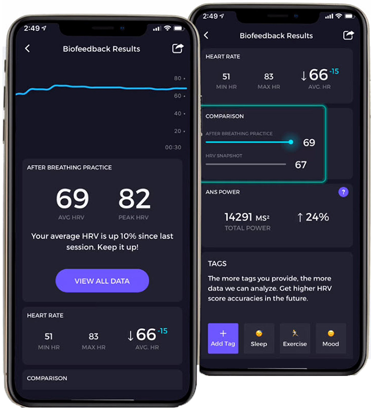 Elite HRV app results