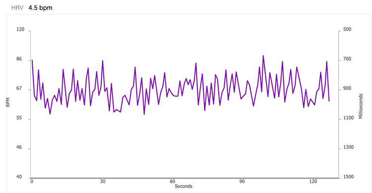 Method 1 - 4.5 bpm tachogram