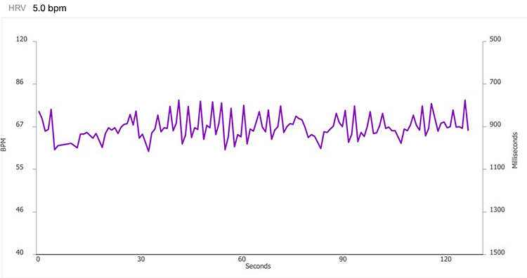 Method 1 - 5.0 bpm tachogram