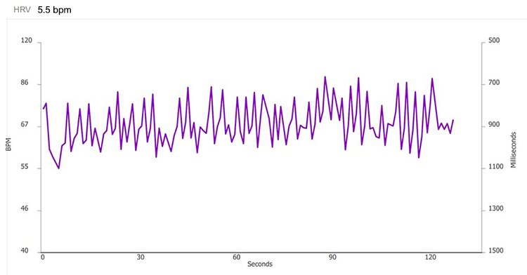 Method 1 - 5.5 bpm tachogram