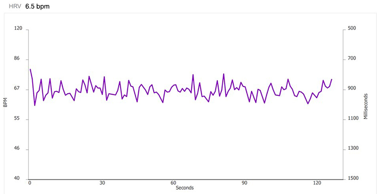 Method 1 - 6.5 bpm tachogram