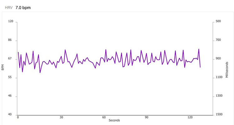 Method 1 - 7.0 bpm tachogram