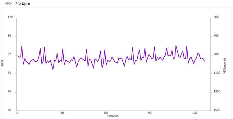 Method 1 - 7.5 bpm tachogram