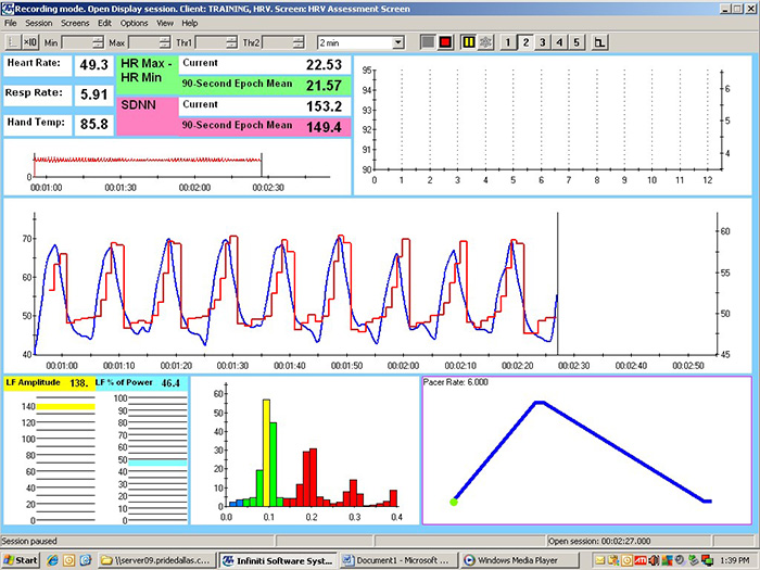Pacing at 6.0 bpm summary screen