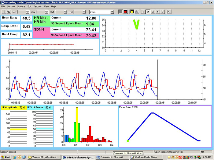 Pacing at 6.5 bpm summary screen