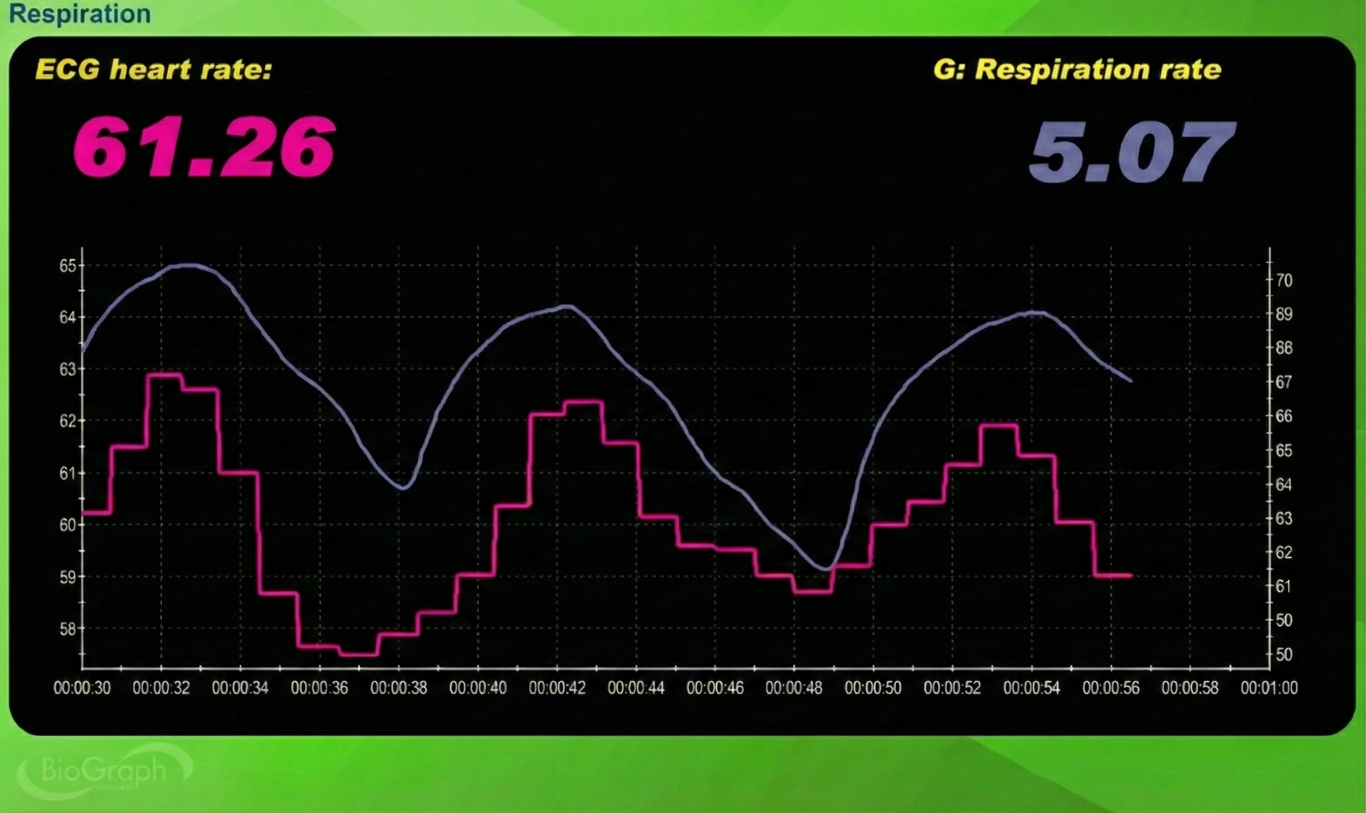 ECG tracking test display