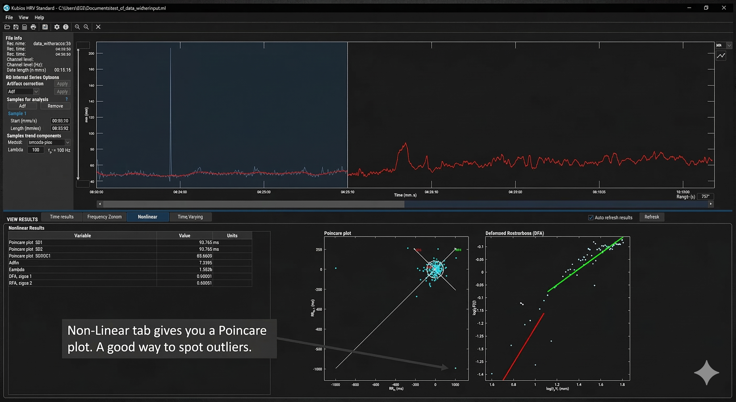 Kubios Non-Linear tab with Poincare plot