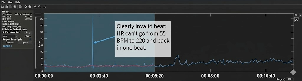 Kubios Time-Domain tab