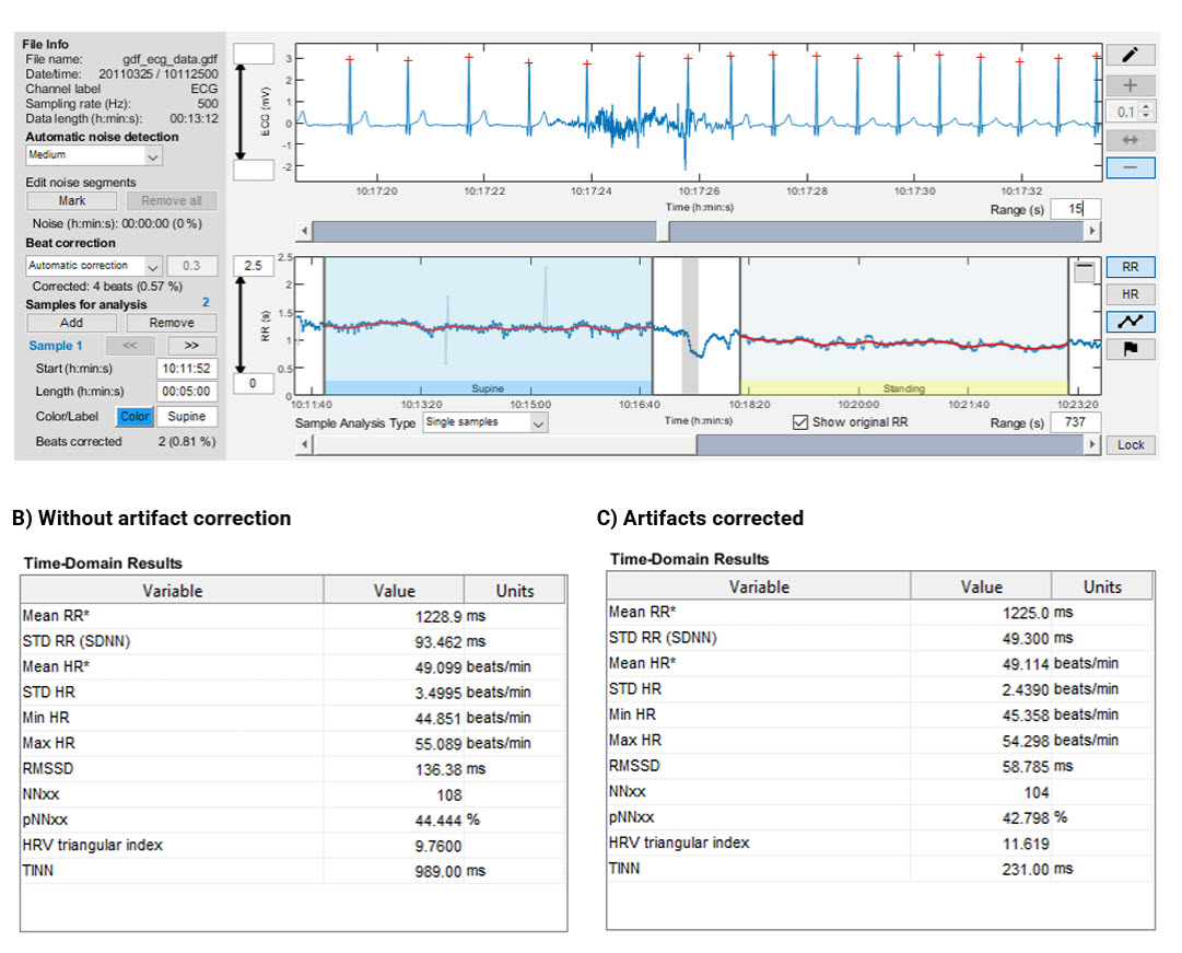 Kubios time-domain results