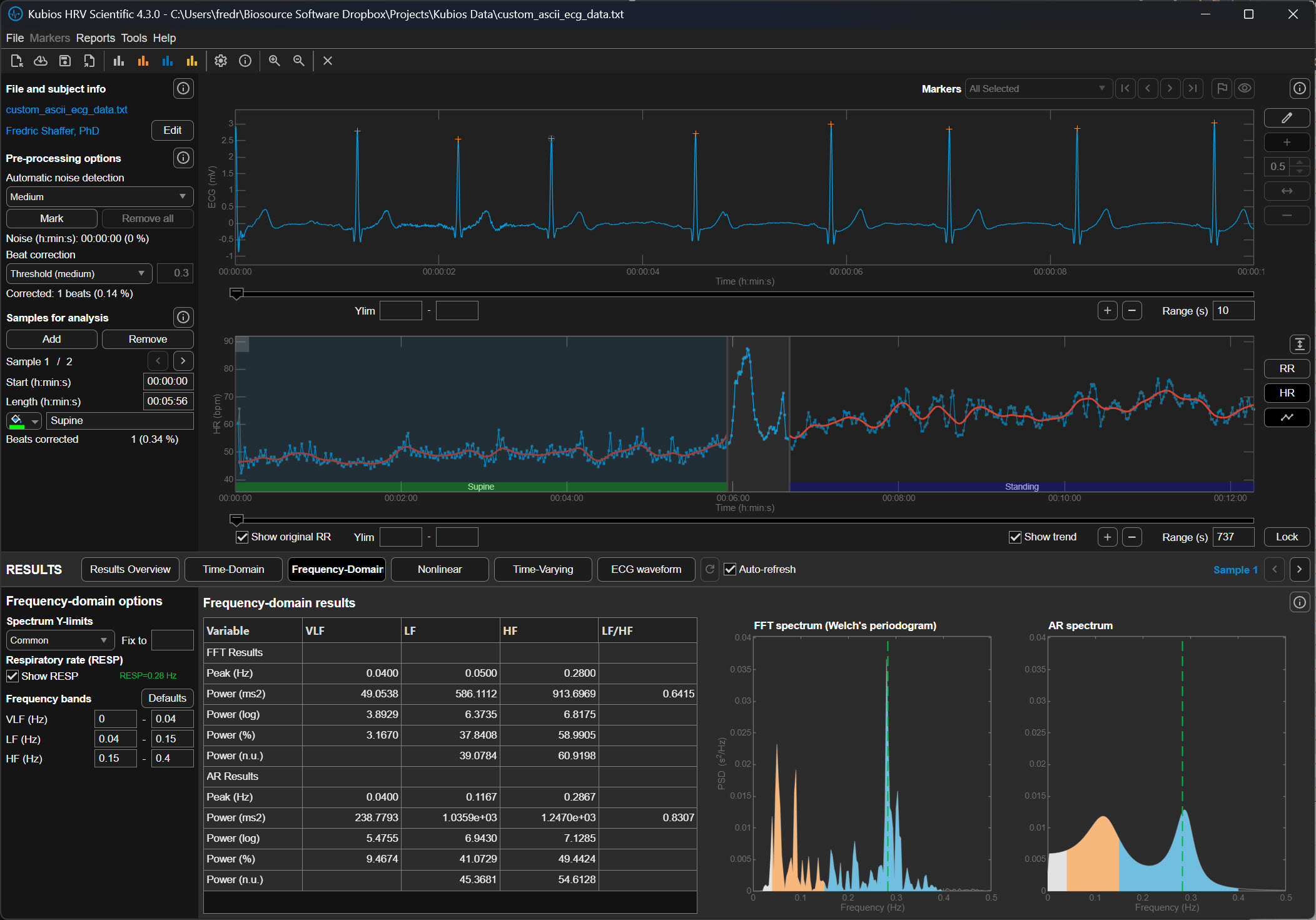 Lambda 250 detrending