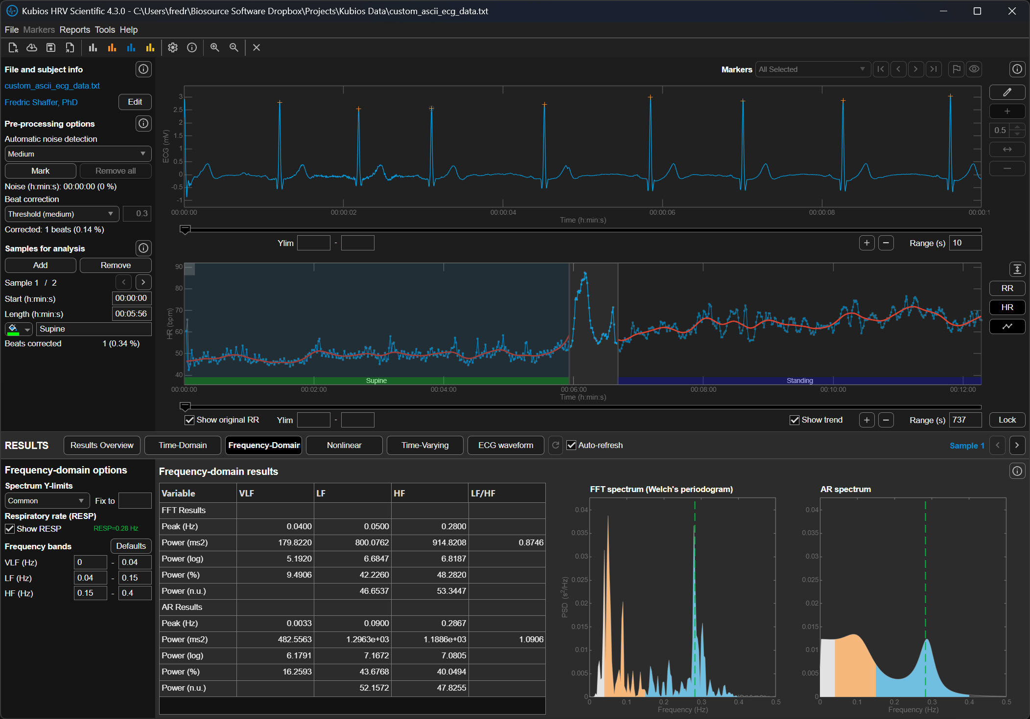Lambda 500 detrending