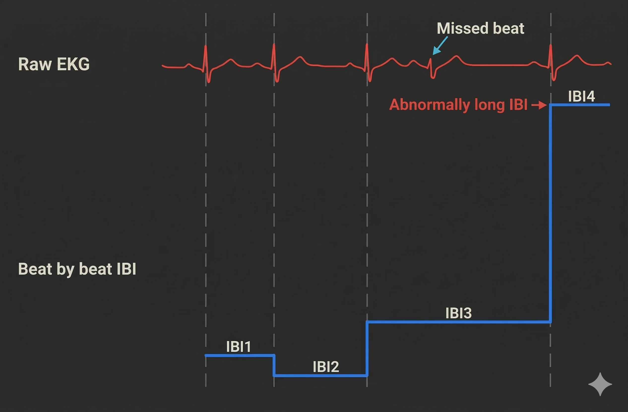 Missed beats lengthening IBIs