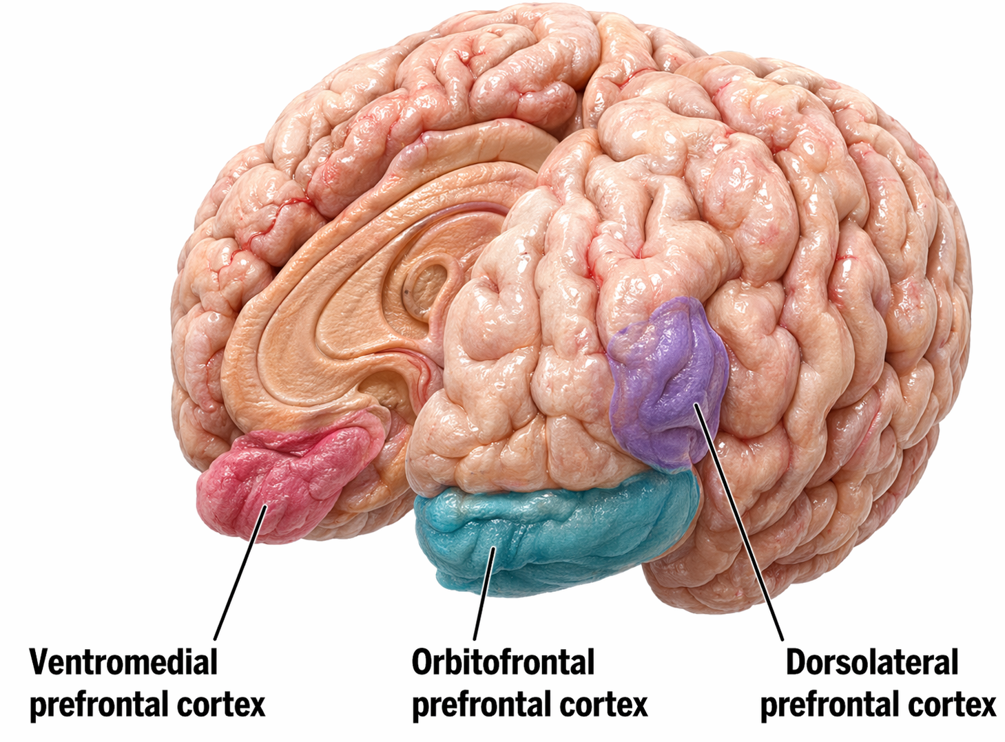 Orbitofrontal cortex