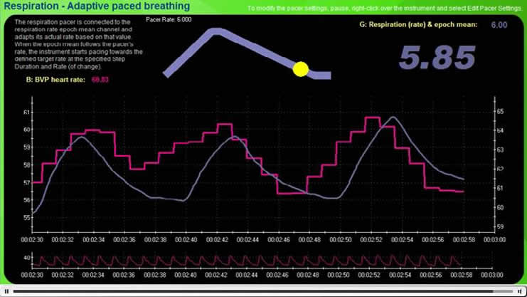 Pacing screen display