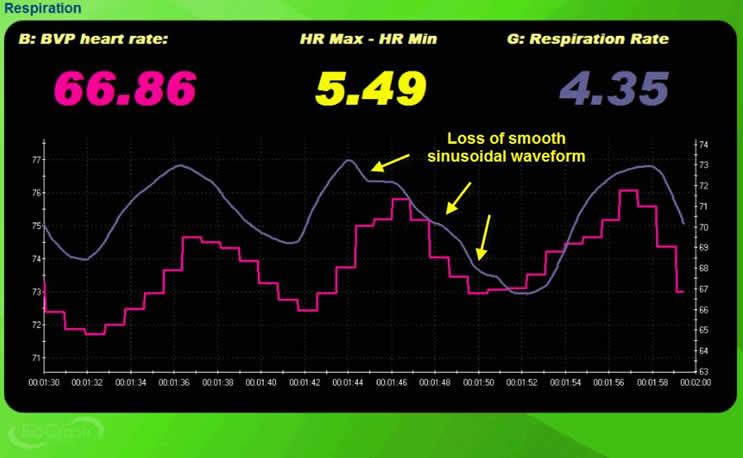 Breathing effort waveform