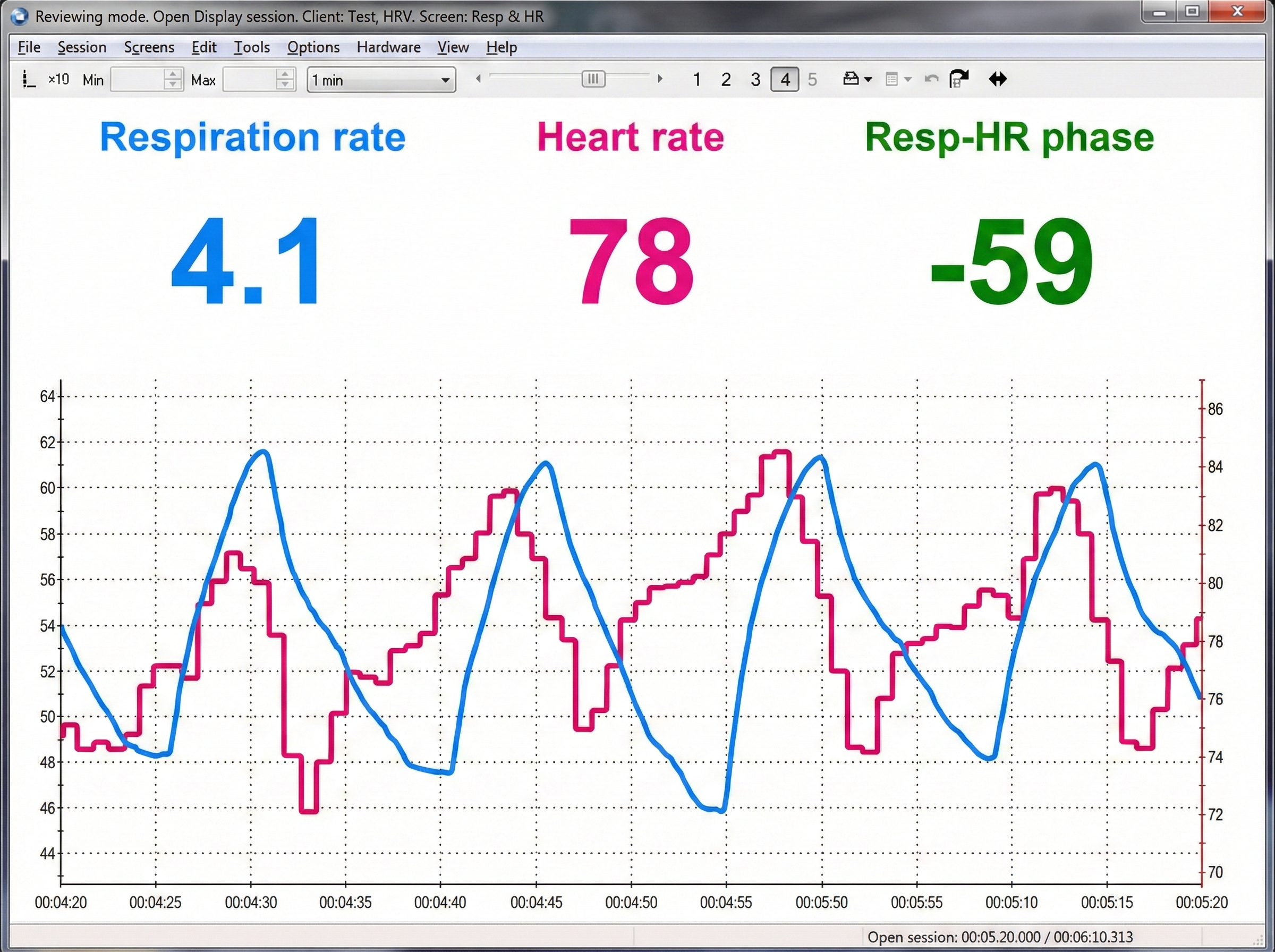 Ideal sinusoidal breathing pattern