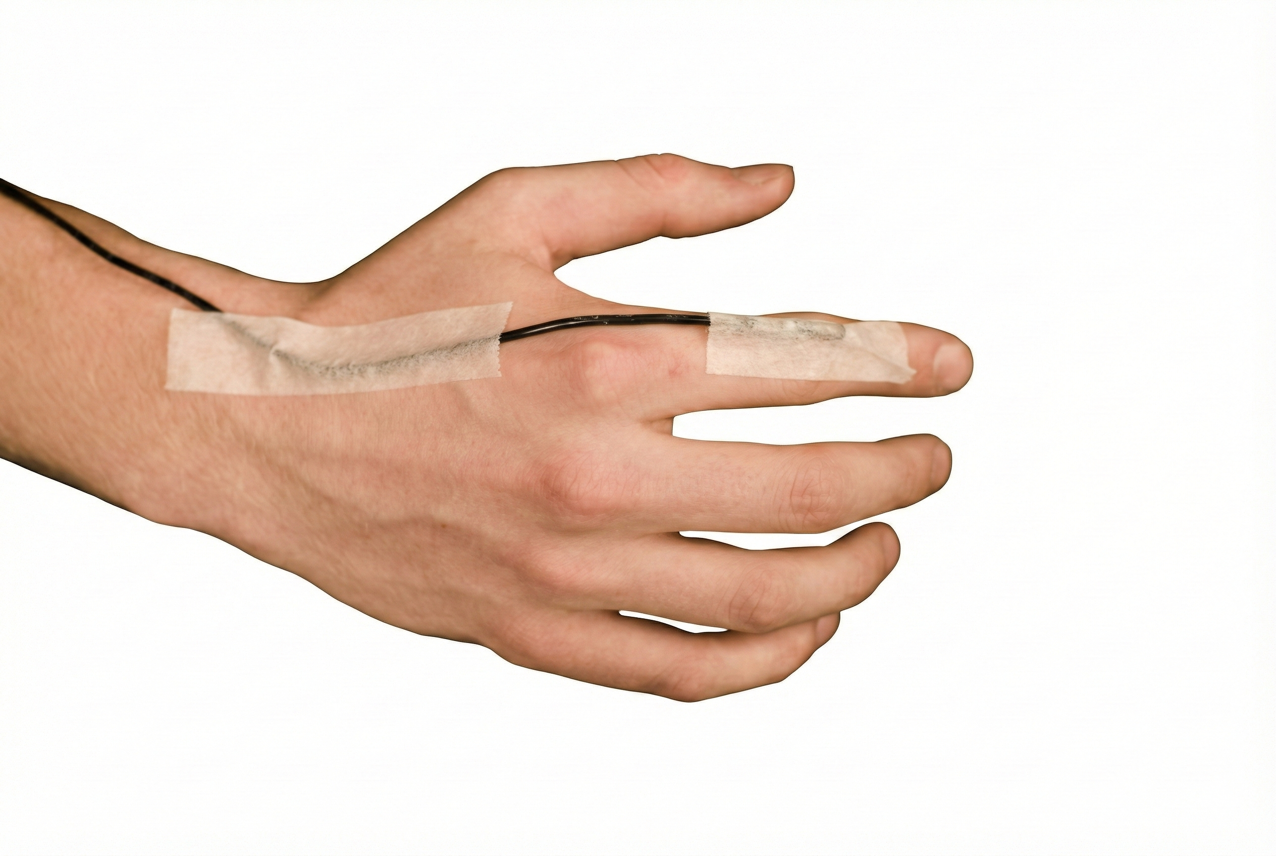 Thermistor placement on finger